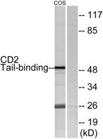 CD2BP2 Polyclonal Antibody