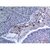 CD300f Polyclonal Antibody