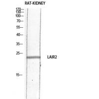 CD306 Polyclonal Antibody