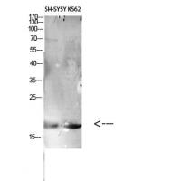 CD306 Polyclonal Antibody