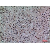 CD307 Polyclonal Antibody