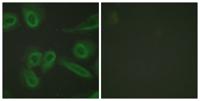 CD31 Polyclonal Antibody