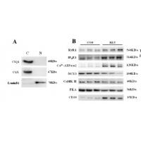 CD38 Polyclonal Antibody