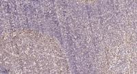 CD3EAP Polyclonal Antibody
