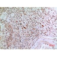 CD3-δ Polyclonal Antibody