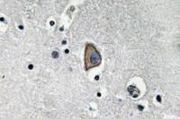 CD3-ε Polyclonal Antibody