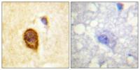 CD4 Polyclonal Antibody