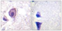 CD4 Polyclonal Antibody