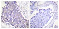 CD40 Polyclonal Antibody