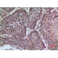 CD42b Polyclonal Antibody