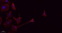 CD45 Polyclonal Antibody