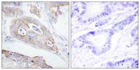 CD45 Polyclonal Antibody