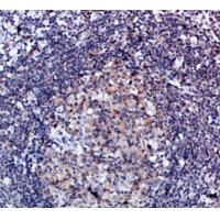 CD47 Polyclonal Antibody