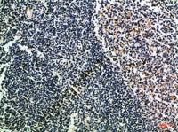 CD52 Polyclonal Antibody