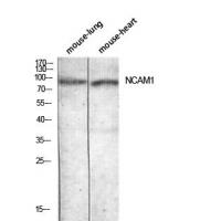 CD56 Polyclonal Antibody