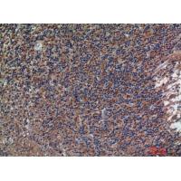 CD56 Polyclonal Antibody