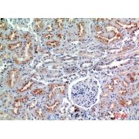 CD56 Polyclonal Antibody