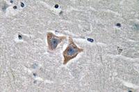 CD57 Polyclonal Antibody