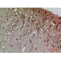 CD58 Polyclonal Antibody