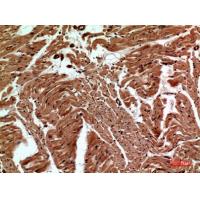 CD59 Polyclonal Antibody