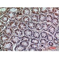 CD59 Polyclonal Antibody