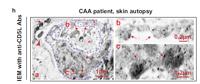 CD5L Polyclonal Antibody