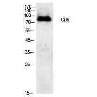 CD6 Polyclonal Antibody