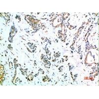 CD64 Polyclonal Antibody