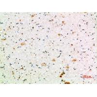 CD64 Polyclonal Antibody