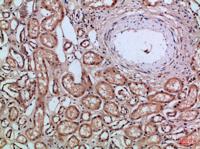 CD66a/b/c Polyclonal Antibody