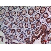 CD66e Polyclonal Antibody