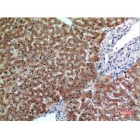 CD66e Polyclonal Antibody