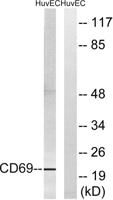 CD69 Polyclonal Antibody