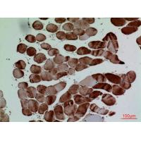 CD7 Polyclonal Antibody