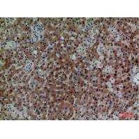 CD7 Polyclonal Antibody