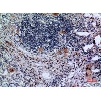 CD71/TfR Polyclonal Antibody