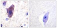 CD71/TfR Polyclonal Antibody