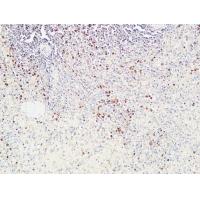 CD72 Polyclonal Antibody