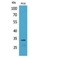CD74 Polyclonal Antibody