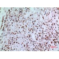 CD74 Polyclonal Antibody