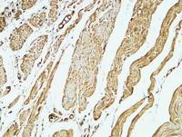 CD79a Polyclonal Antibody