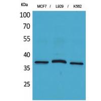 CD79b Polyclonal Antibody