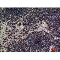 CD79b Polyclonal Antibody