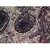 CD79b Polyclonal Antibody