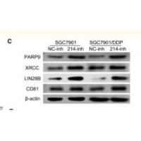 CD81 Polyclonal Antibody