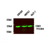 CD81 Polyclonal Antibody