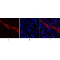 CD81 Polyclonal Antibody