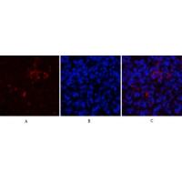 CD81 Polyclonal Antibody
