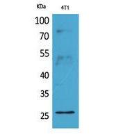 CD81 Polyclonal Antibody