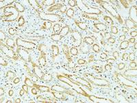 CD83 Polyclonal Antibody